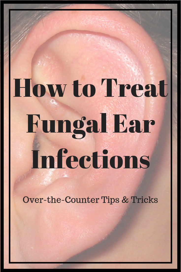 How to Treat Fungal Ear Infections