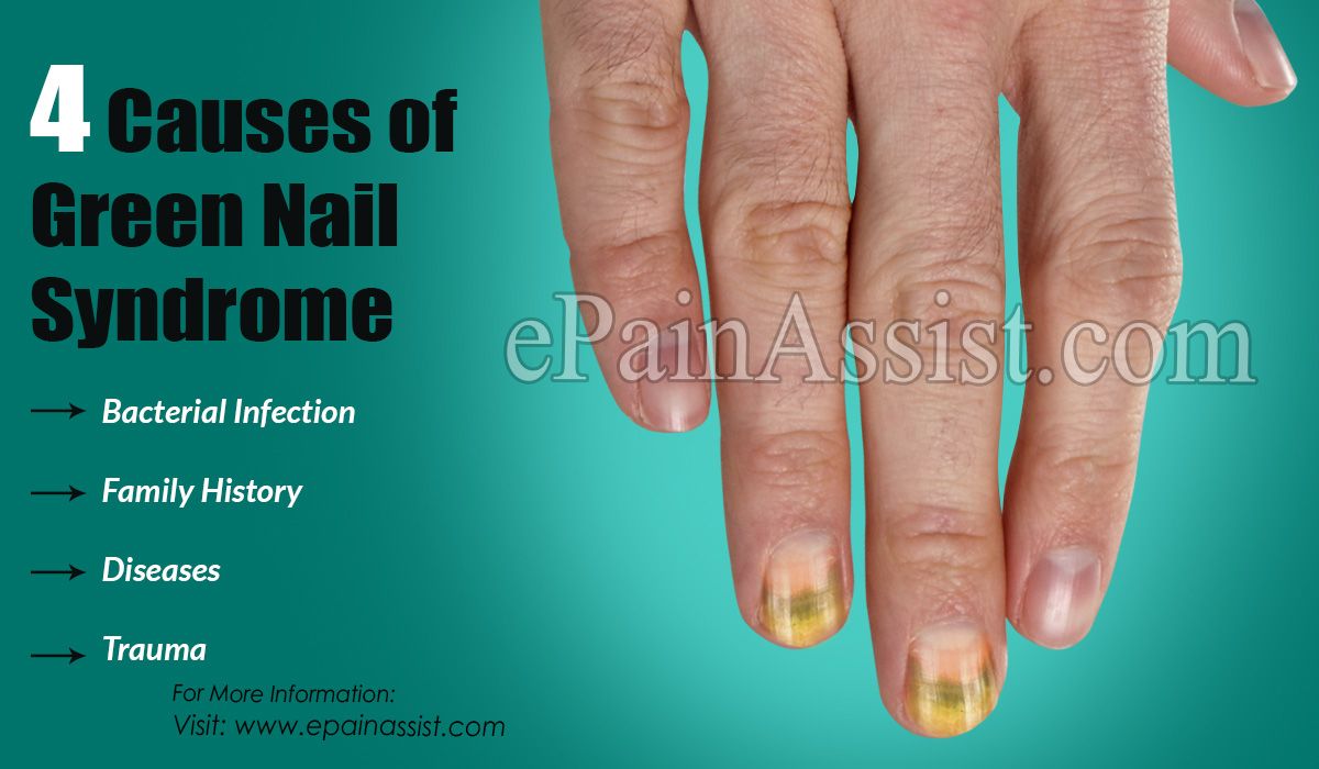 How To Treat Green Nails At Home