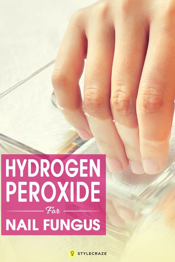 How To Use Hydrogen Peroxide For Nail Fungus â A Step By ...