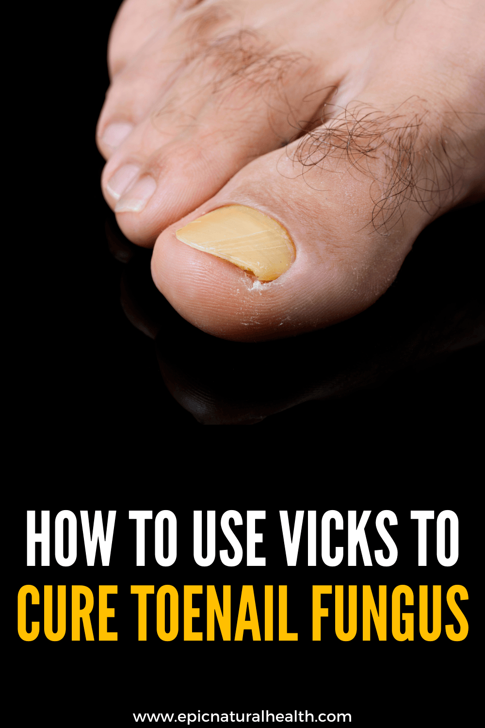 How To Use Vicks To Treat &  Cure Toenail Fungus â FAST EASY REMEDY ...