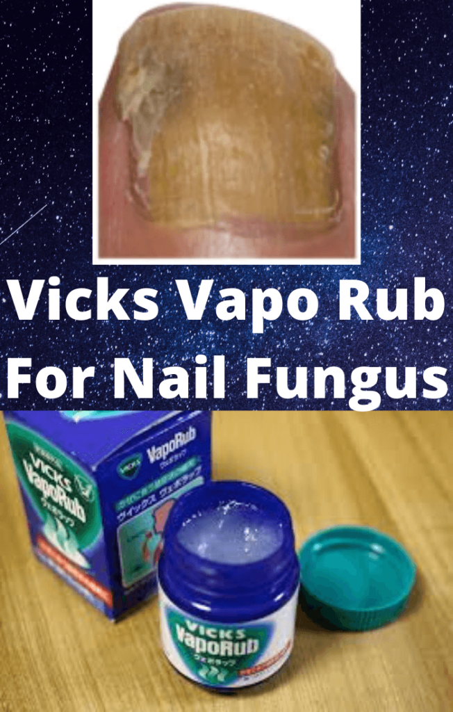How To Use Vicks Vapour Rub For Nail Fungus Effectively