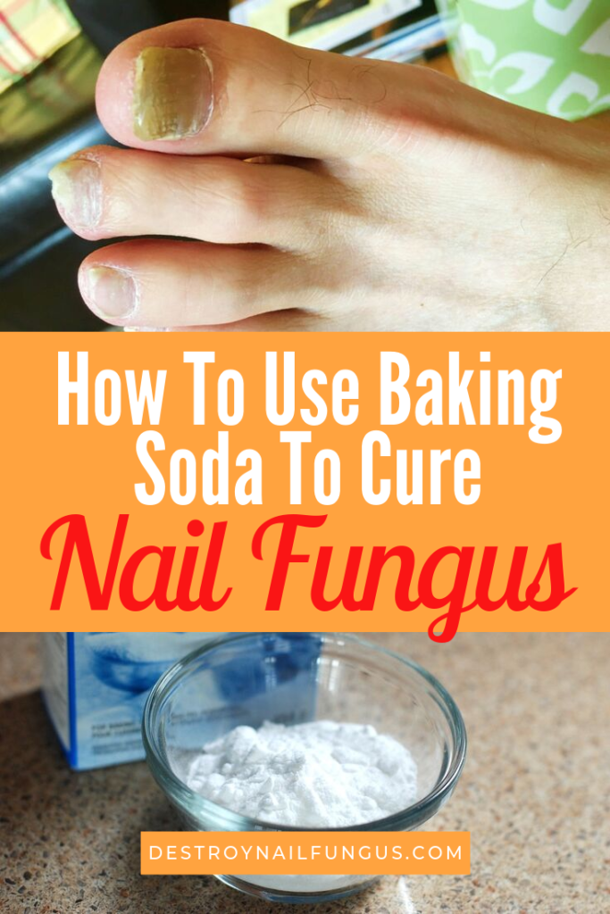 How You Can Use Baking Soda To Fight Toenail Fungus (Now!)