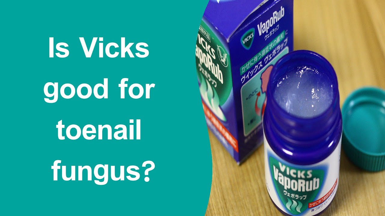 Is Vicks good for toenail fungus?