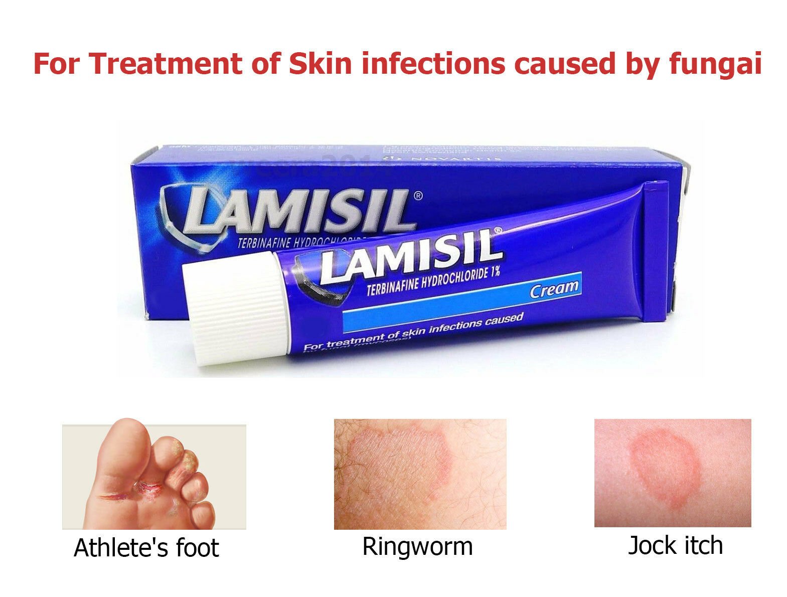 LAMISIL cream 1% Terbinafine treatment fungal skin infection Athlete