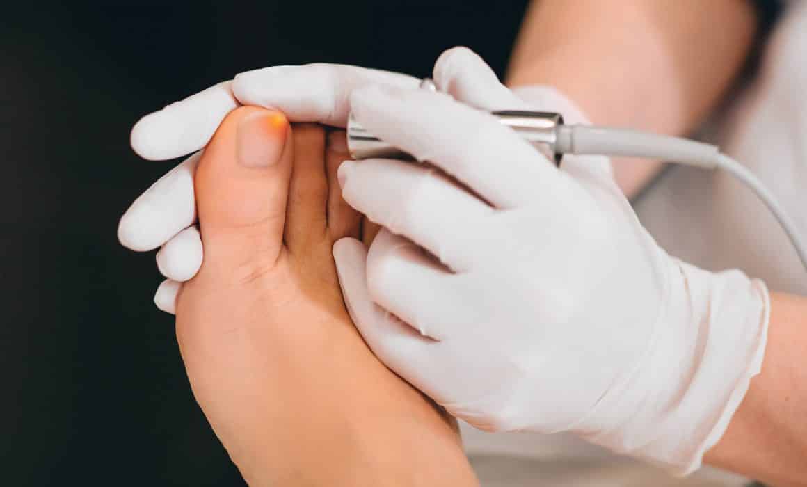 Laser Treatments For Patients Suffering From Toenail ...