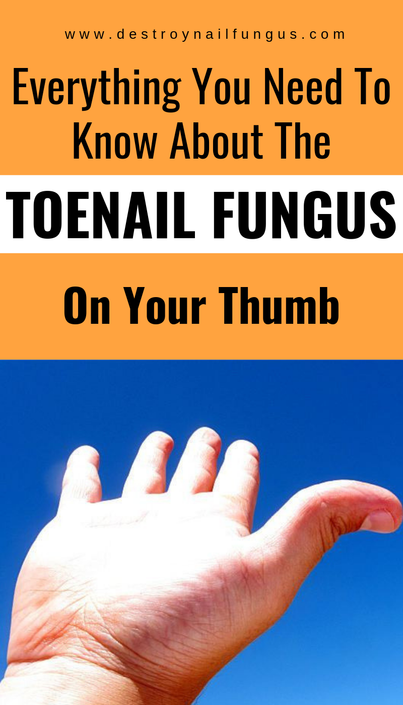 Nail fungus is one of the most common fungal infections in ...
