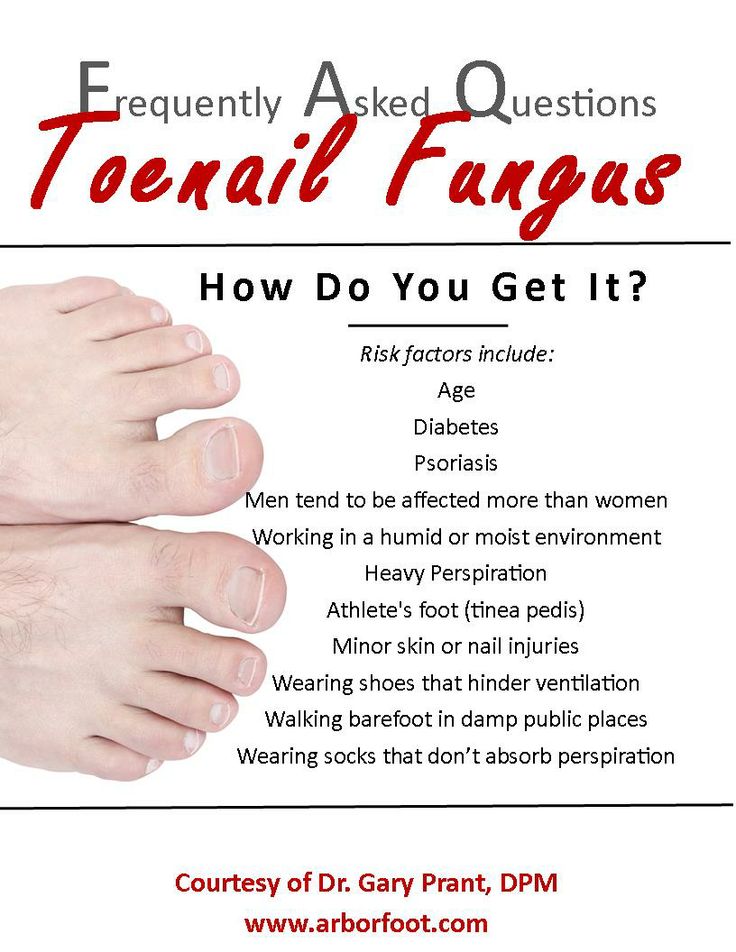 Pin by Arbor Foot Health Center on Toe Tips
