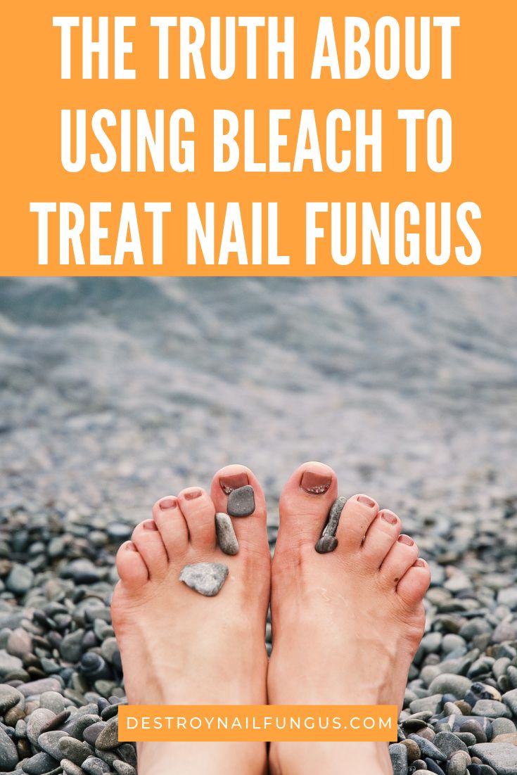 Pin on Nail Fungus cure finger