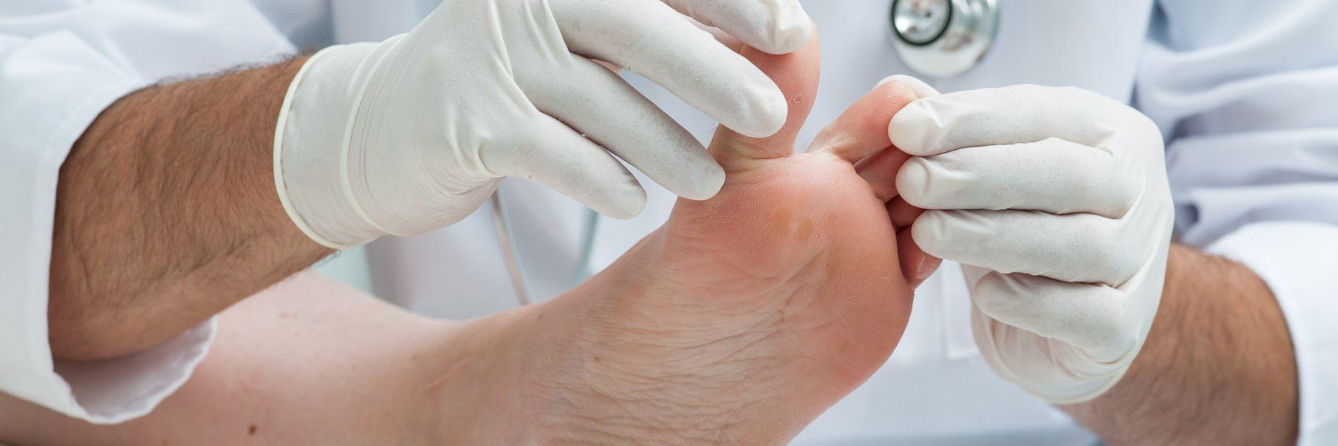 Rothman Orthopaedic Institute Provides The Best Toe Nail ...