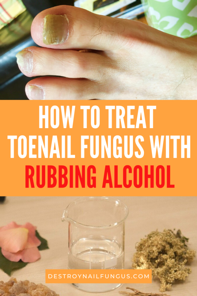 Rubbing Alcohol For Toenail Fungus: The Complete Guide