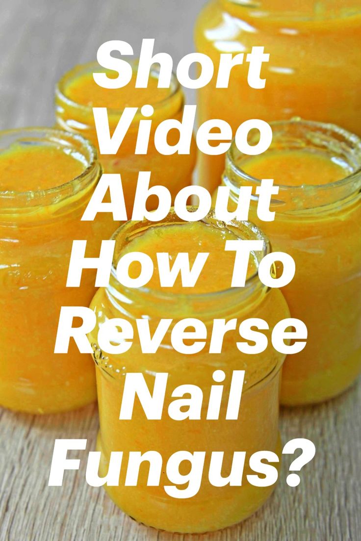 Short Video About How To Reverse Nail Fungus?