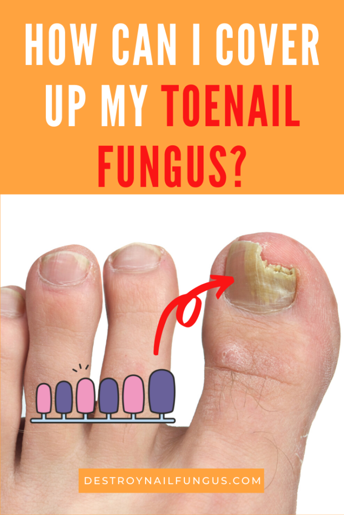 Should You Get Fake Toenails For Fungus? Know The Real ...