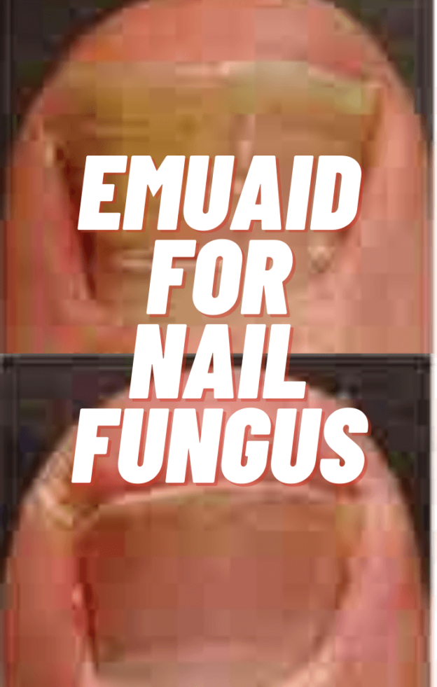Step By Step Guide To Use Emuaid For Nail Fungus In 2021