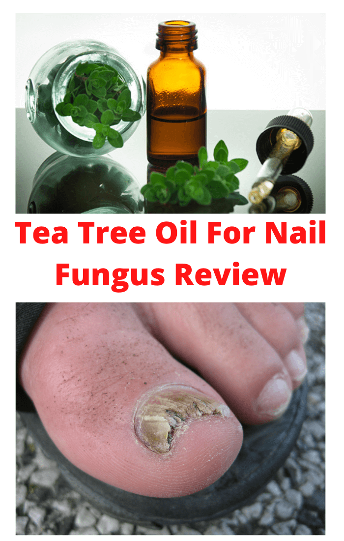 Tea Tree Oil For Nail Fungus Review (Honest &  Helpful)