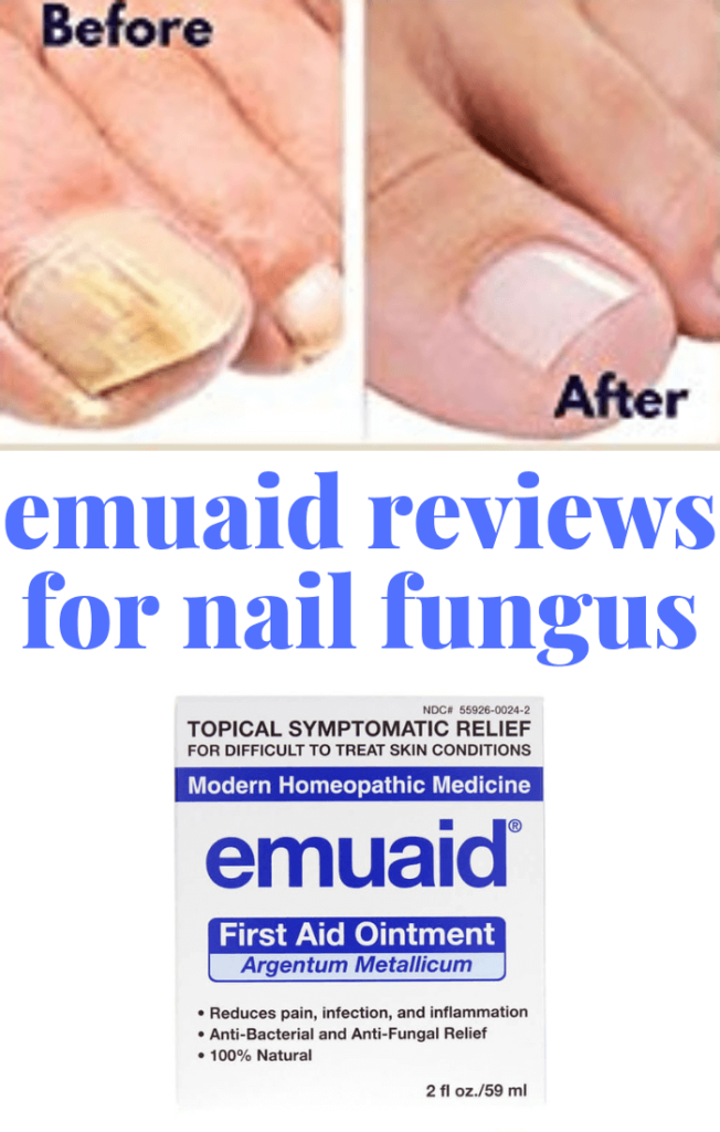 The Ultimate Emuaid Reviews For Nail Fungus (Verified)