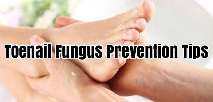 Toenail Fungus Prevention Tips #NailFungus