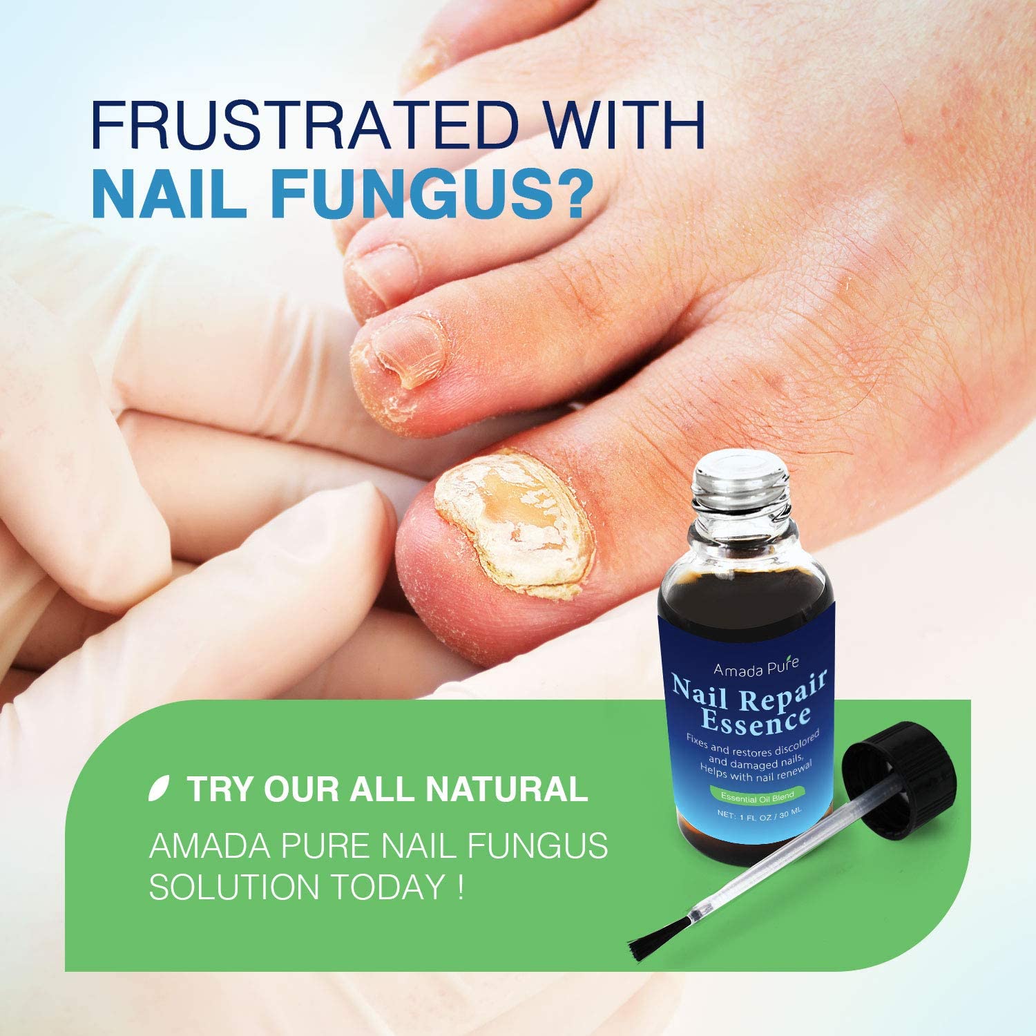 Toenail Fungus Treatment, Nail Fungus Treatment, Fungus Stop ...