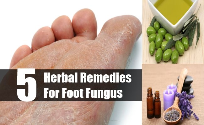 Top 5 Herbal Remedies For Foot Fungus