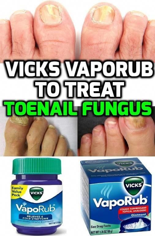 Vicks Vaporub contains antimicrobial, anti