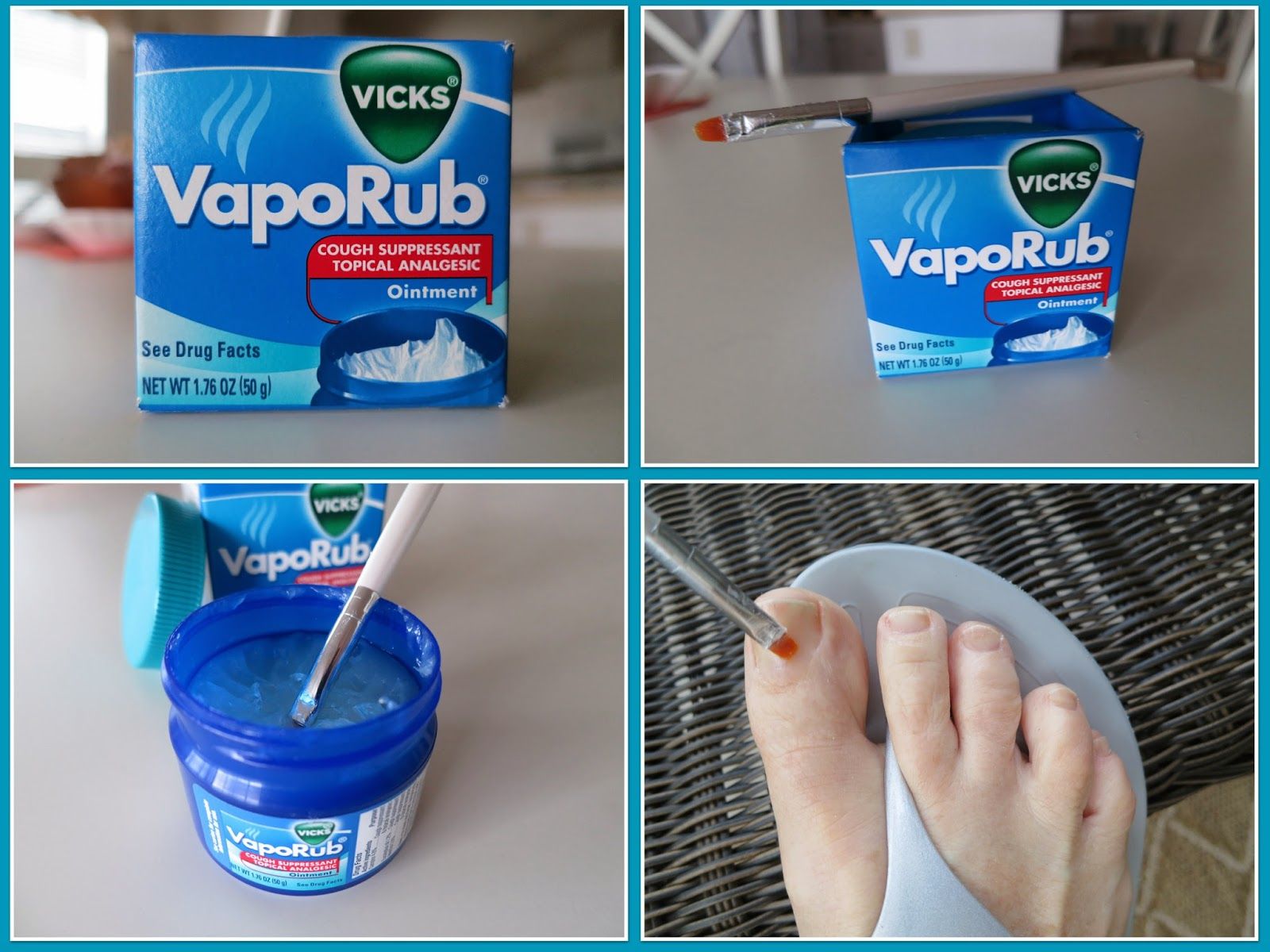 vicks vaporub for nail fungus cure