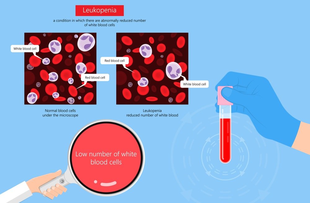 What Does Low White Blood Cell Count Mean?