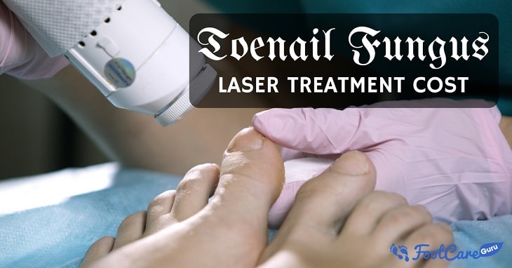 What Does The Laser Toenail Fungus Removal Cost ...