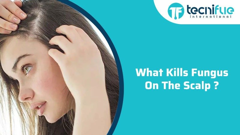 What Kills Fungus On Scalp? » TecniFUE Best Hair Transplant