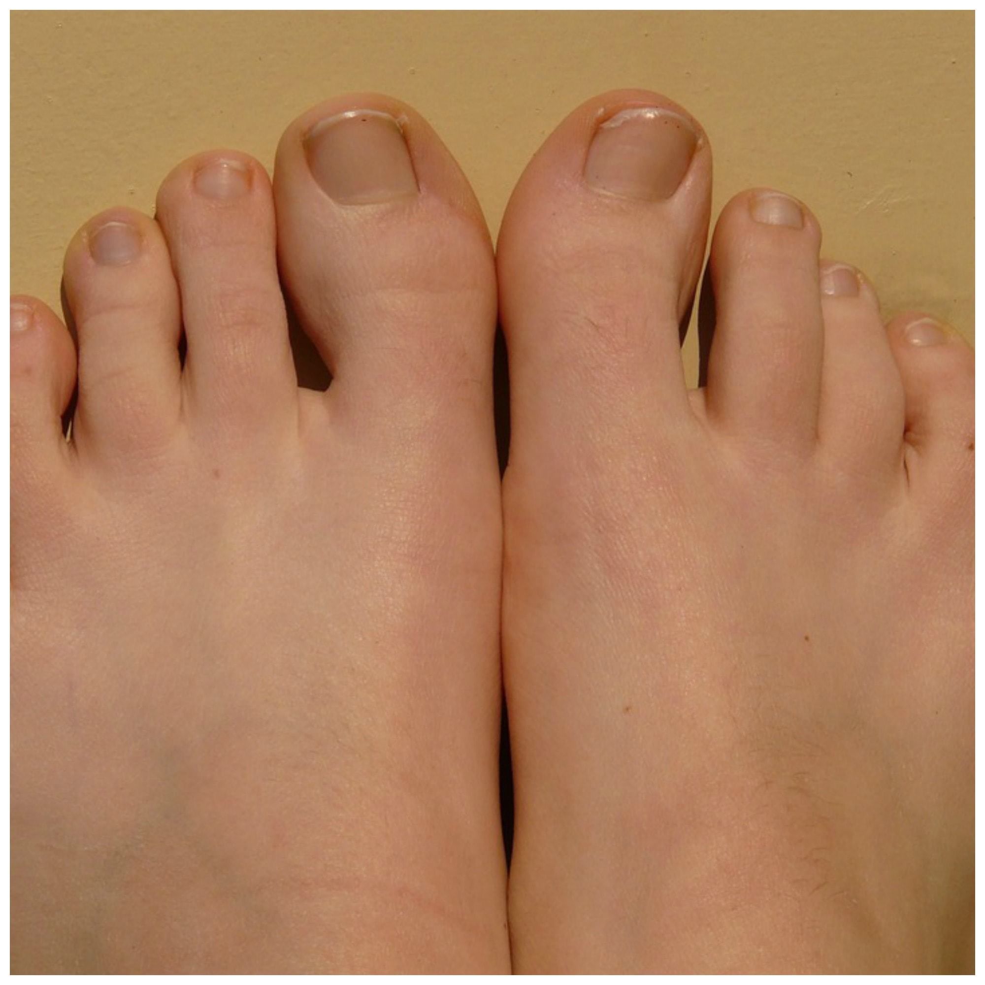 Why Do You Put Essential Oils On Your Feet?